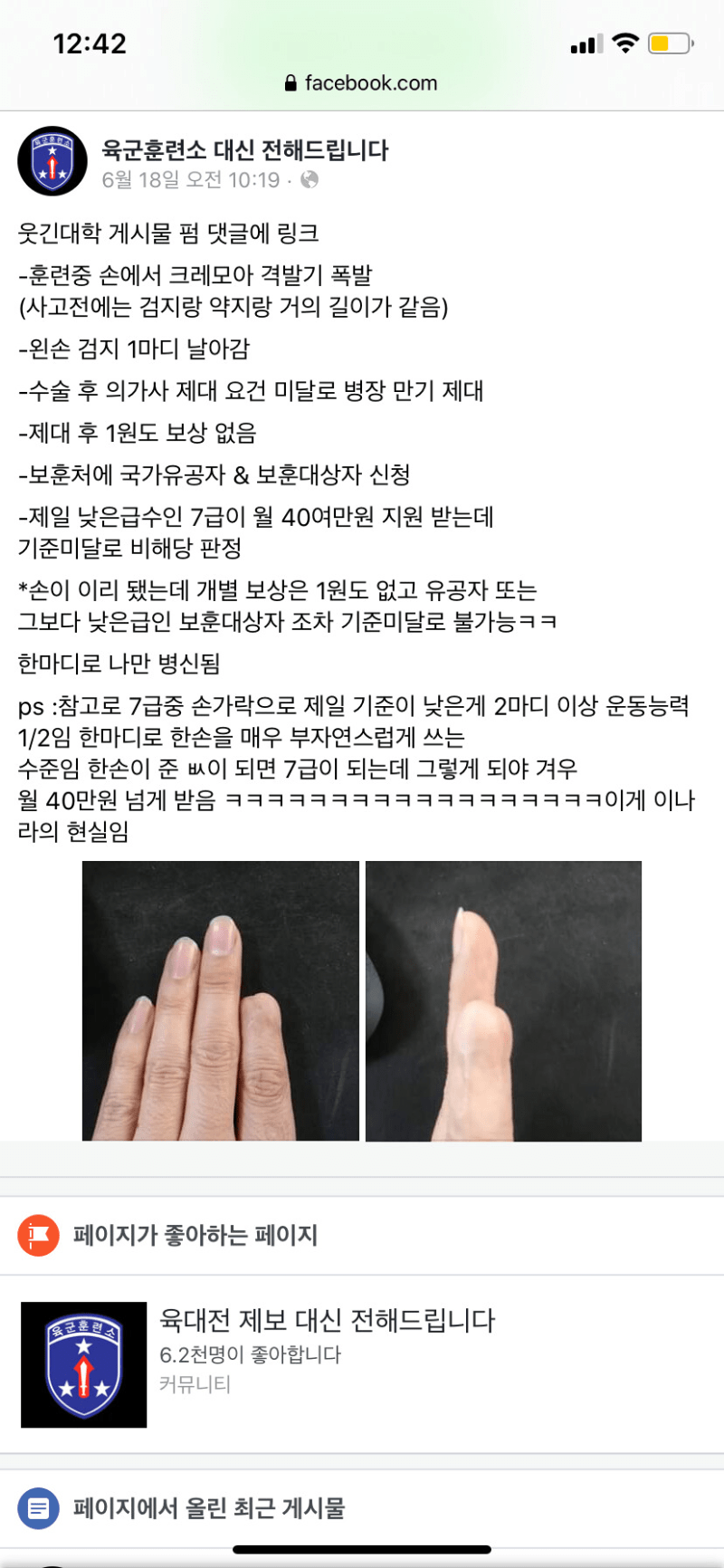 훈련중 크레모아 격발기 피해 후기